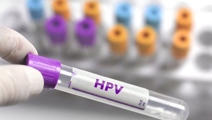 Screening Diagnostici e Peculiarità degli Esami e Check-up per prevenire e identificare papilloma virus