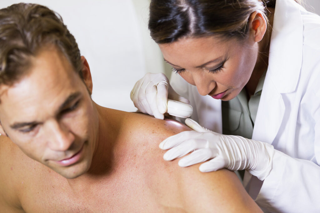 Melanoma in aumento: i numeri italiani parlano chiaro