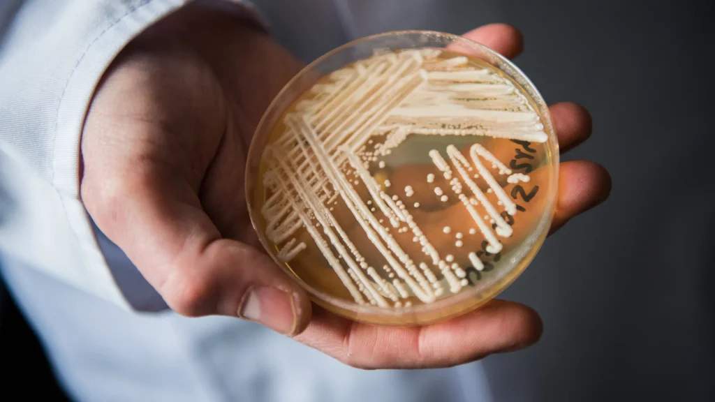 Candida auris: sintomi da non sottovalutare
