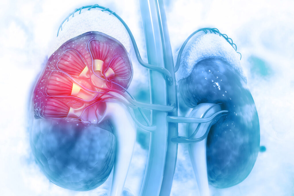 Malattia renale cronica: sfida di sistema per la sanità pubblica