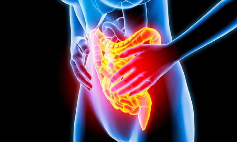 Colite ulcerosa, nuova opportunità terapeutica con l’approvazione Aifa di etrasimod